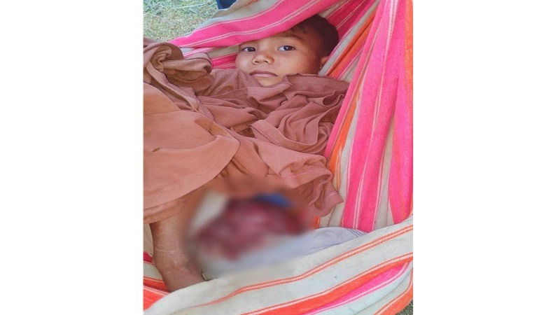 রাঙামাটিতে জেএসএস-ইউপিডিএফের বন্দুকযুদ্ধে ত্রিপুরা শিশু গুলিবিদ্ধ