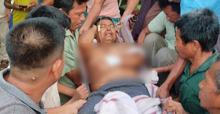 রাঙ্গামাটিতে দুর্বৃত্তদের গুলিতে ইউপি চেয়ারম্যান আহত
