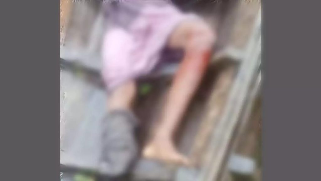 মিয়ানমারের লালচরে মাইন বিস্ফোরণে বাংলাদেশি যুবক আহত