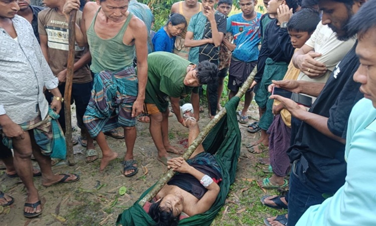 ঘুমধুম সীমান্তে মাইন বিস্ফোরণে মিয়ানমারের রাখাইন যুবকের পা বিচ্ছিন্ন