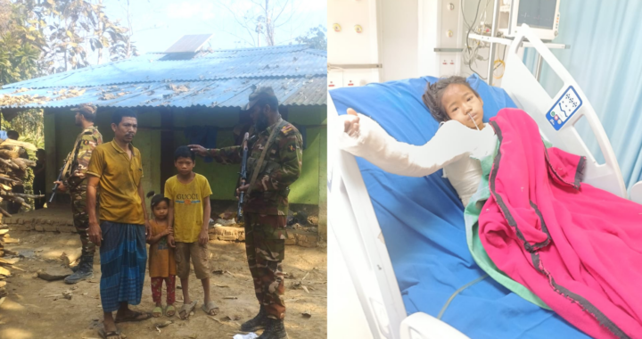 বর্মাছড়ির অগ্নিদগ্ধ নিশনা চাকমার পাশে লক্ষীছড়ি জোন, চিকিৎসায় আর্থিক সহায়তা প্রদান