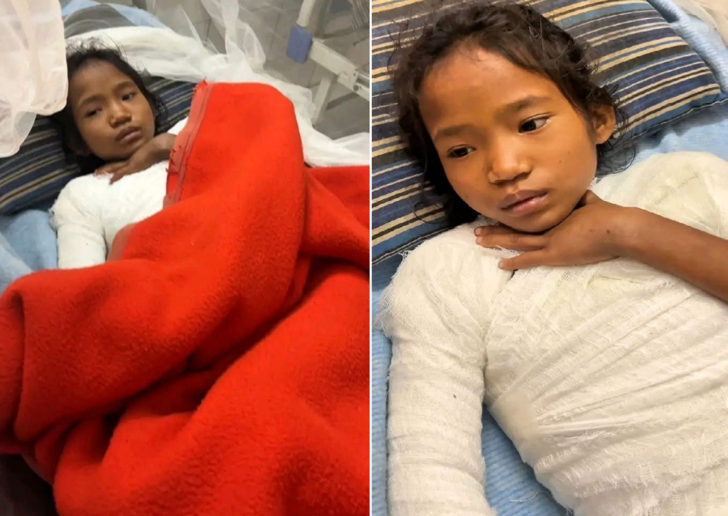 ভয়াবহ আগুনে দগ্ধ লক্ষীছড়ির শিক্ষার্থী নিশনা চাকমা, জরুরি আর্থিক সাহায্যের আবেদন