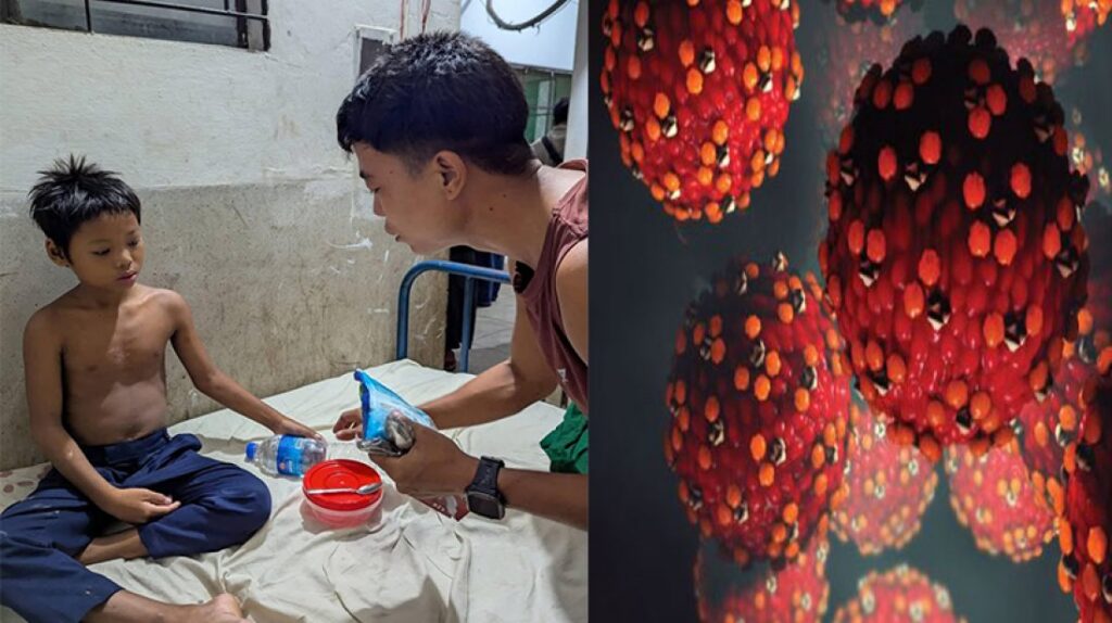 পার্বত্য এলাকায় হামের প্রাদুর্ভাব, জরুরি মেডিকেল ক্যাম্পের দাবি চুক্তি বাস্তবায়ন আন্দোলনের