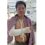 খাগড়াছড়িতে অকটেন না পেয়ে ট্যাগ অফিসারের হাত ভেঙ্গে দিলো কয়েকজন যুবক!