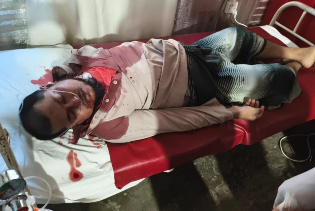 উখিয়ায় রোহিঙ্গা ক্যাম্পে প্রতিপক্ষের গুলিতে রোহিঙ্গা নেতা নিহত