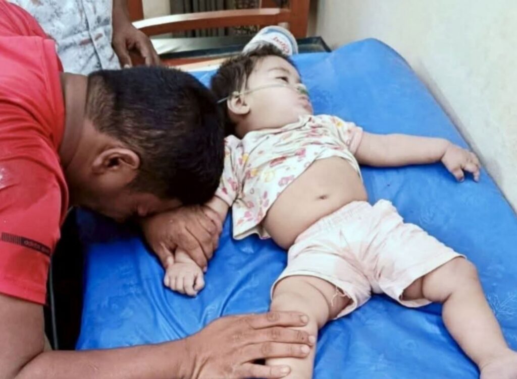 কক্সবাজারের চকরিয়ায় গলায় লিচুর বিচি আটকে শিশুর মৃত্যু