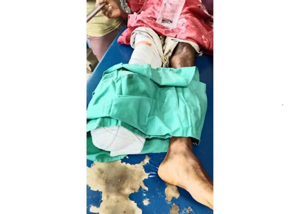 উখিয়ায় মাইন বিস্ফোরণে বাংলাদেশির পায়ের গোড়ালি বিচ্ছিন্ন