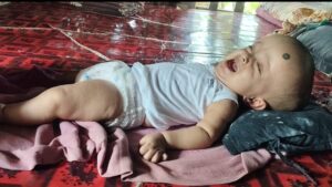পাঁচ মাসের অসুস্থ মেয়েকে বাঁচাতে অসহায় আমেনার আকুতি, প্রয়োজন মানবিক সহায়তা