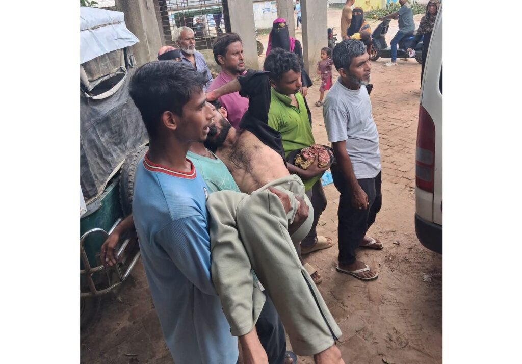 দীঘিনালায় এলটি লাইনে কাজ করতে গিয়ে বিদ্যুৎস্পৃষ্ট, যুবক গুরুতর আহত
