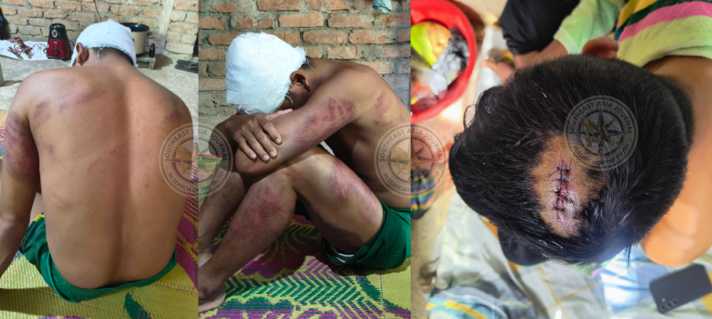 খাগড়াছড়িতে অস্ত্রের মুখে মারমা যুবককে অপহরণ করে নির্যাতন করল ইউপিডিএফ সন্ত্রাসীরা, অবস্থার অবনতি