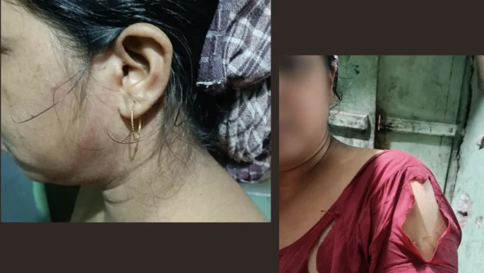 পশ্চিমবঙ্গে নির্যাতনের শিকার ৩ খ্রিষ্টান পরিবার: হিন্দু ধর্মে ধর্মান্তরিত চেষ্টার অভিযোগ